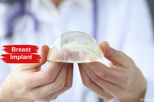 Cirugía de implantes mamarios en Turquía 2023 (La nueva y mejor guía)