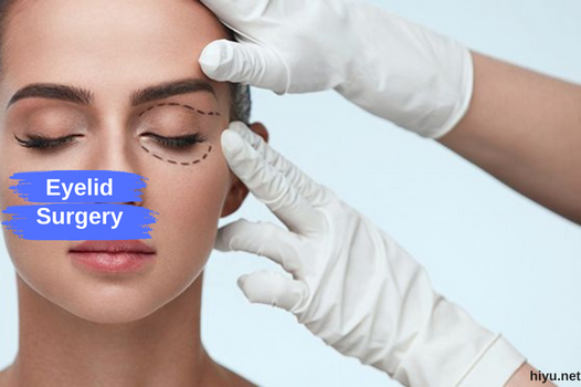 Eyelid Surgery in Turkey 2023 (The Best and New Guide)