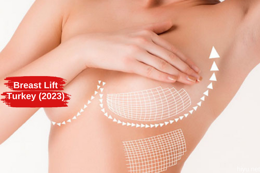 Breast Lift in Turkey 2023: Get Your Confidence Back (The Best Guide)