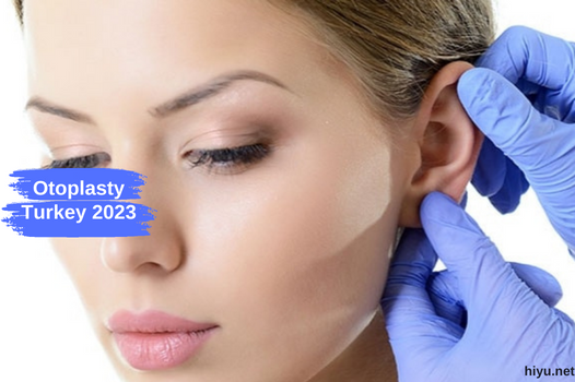 Otoplasty in Turkey 2023: The Best Guide for Your Journey: Discover With Us!