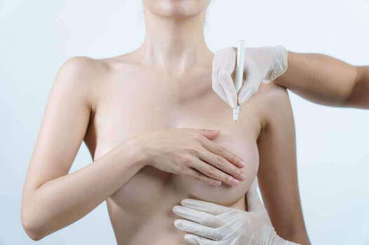 Breast Lift in Turkey 2023