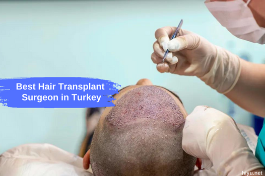 How to Choose the Best Hair Transplant Surgeon in Turkey? (The best guide to 2023)