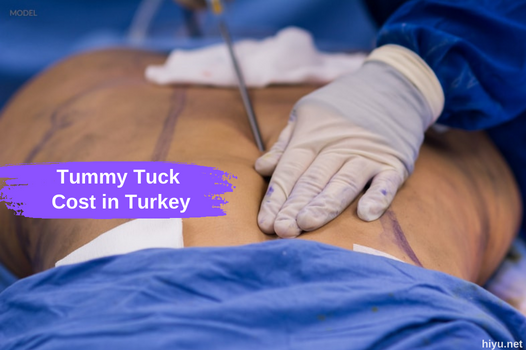 ¿Cuánto cuesta una abdominoplastia en Turquía 2023? La mejor guía