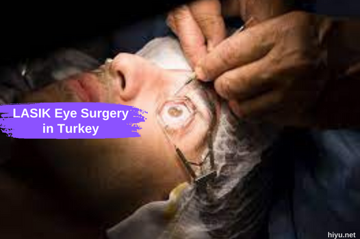 LASIK Eye Surgery in Turkey