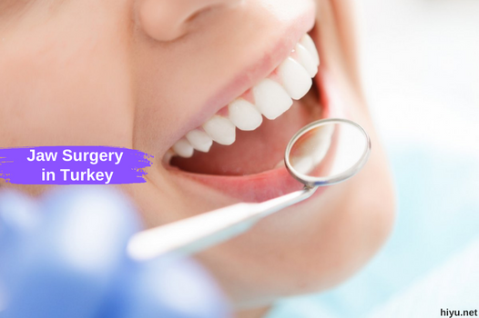 Su guía completa para la cirugía de mandíbula en Turquía: saque su mejor sonrisa 2023