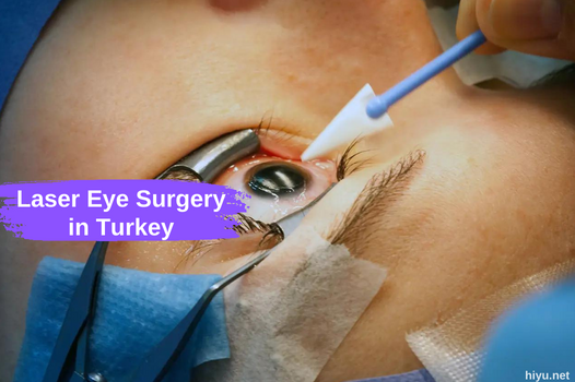 Laser Eye Surgery in Turkey