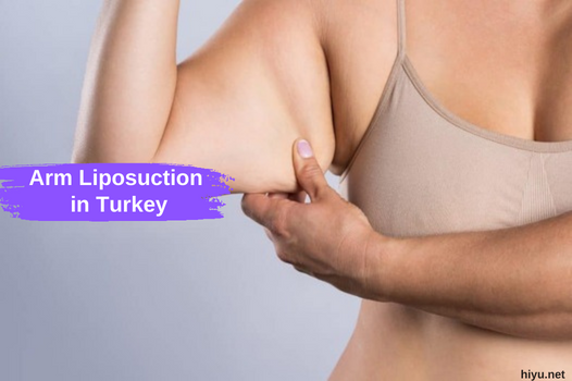 Arm Liposuction in Turkey 2023: The Best Guide