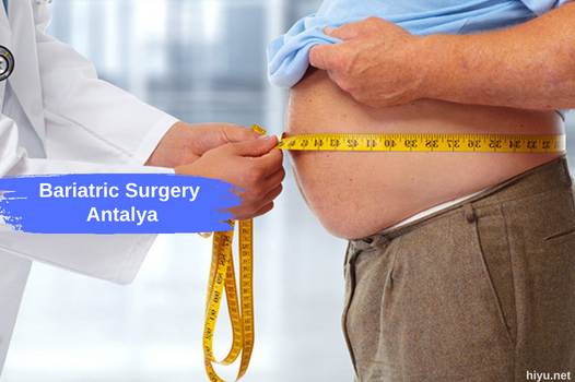 Bariatric Surgery Antalya: An All-Inclusive Guide to Your Weight Loss Journey in 2024