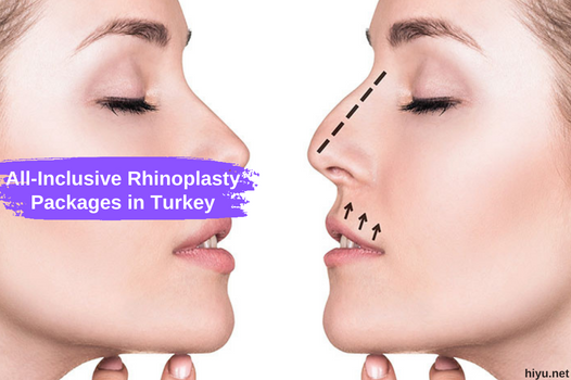 All-Inclusive Rhinoplasty Packages in Turkey: Your Ultimate Solution for Nose Surgery 2023
