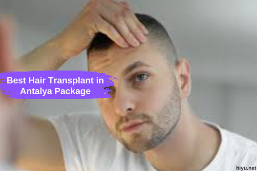 Best Hair Transplant in Antalya Package: The Best and Detailed Guide in 2024
