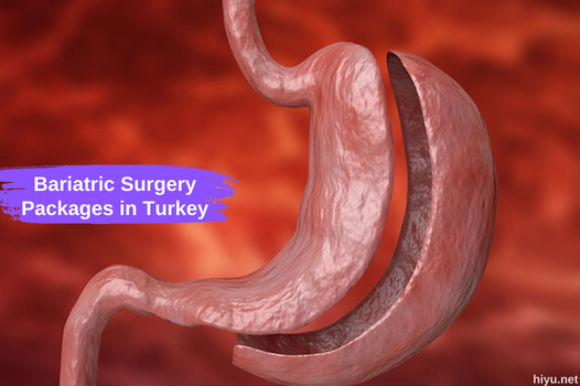 Bariatric Surgery Packages in Turkey: The Best Info in 2024