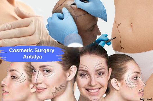 Cosmetic Surgery Antalya: The Best Plastic Surgery in 2023