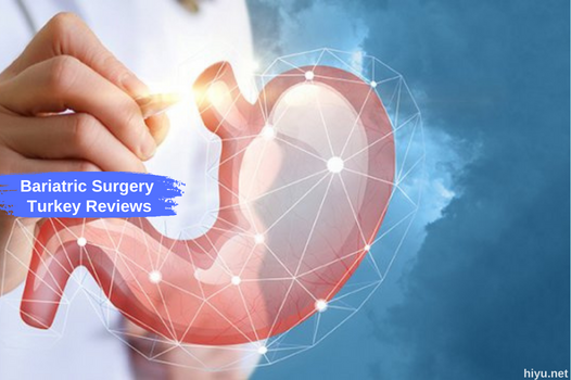 Bariatrische chirurgie Turkije beoordelingen: een uitgebreide gids in 2023