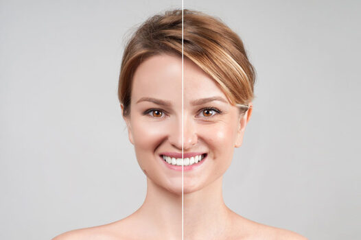 Best Botox Clinic in Istanbul